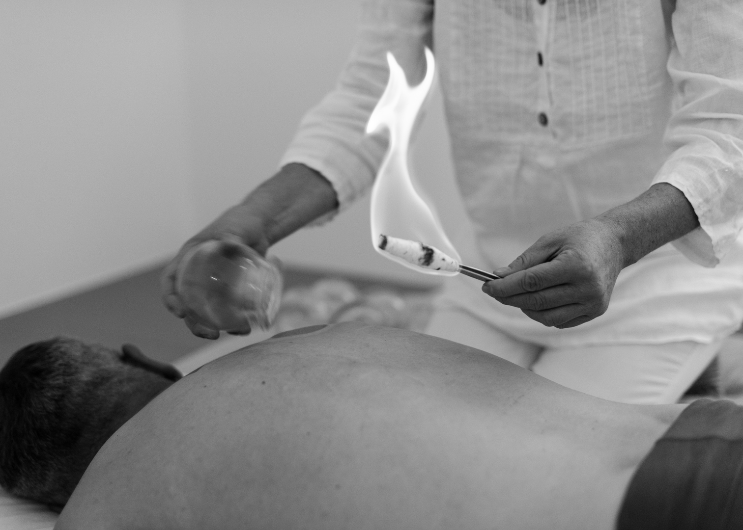 Shiatsu Feuerschröpfen Behandlung