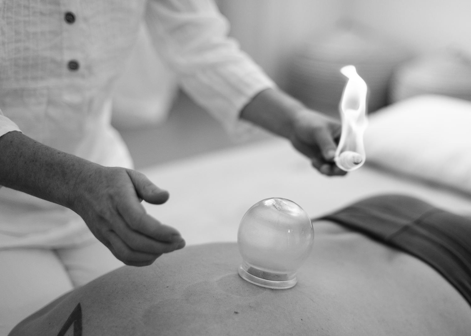 Shiatsu Feuerschröpfen Behandlung